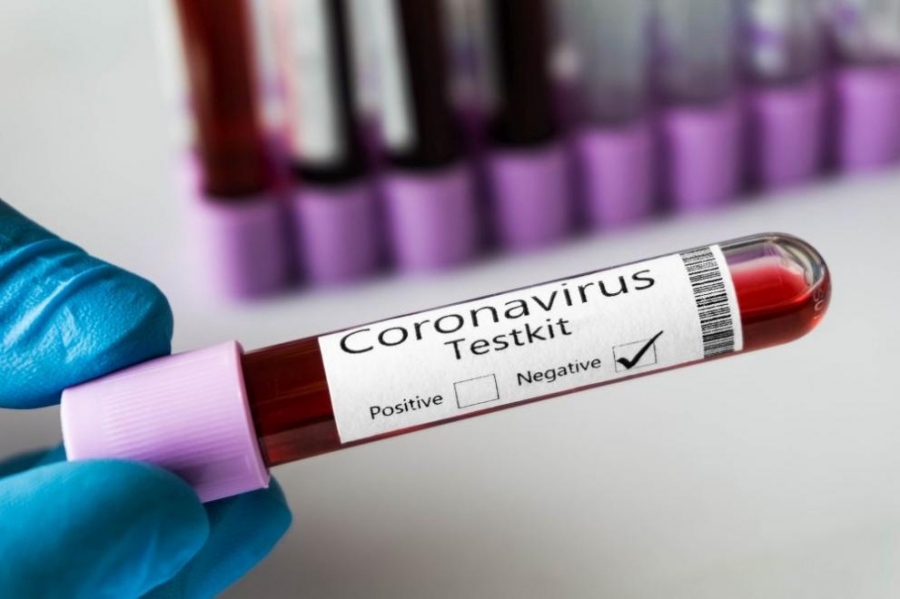 Ирландия изисква отрицателен тест за коронавирус от пристигащите в страната